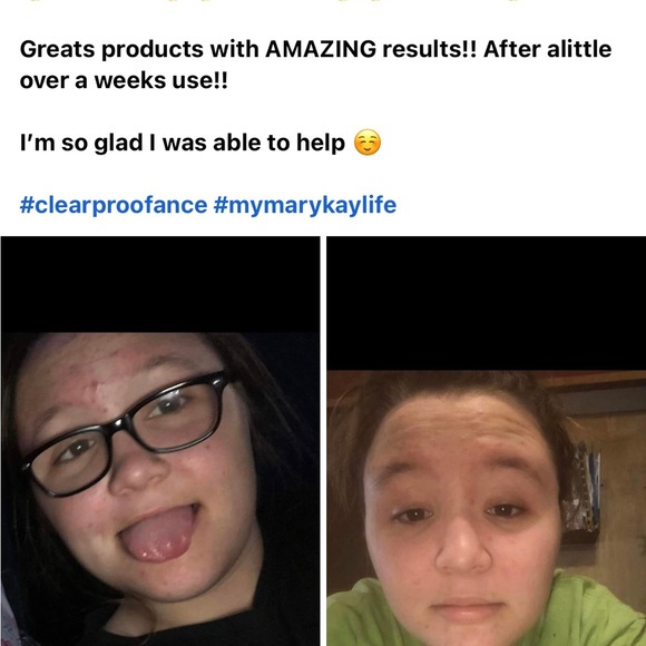 Acne system! - Picture 2 of 4